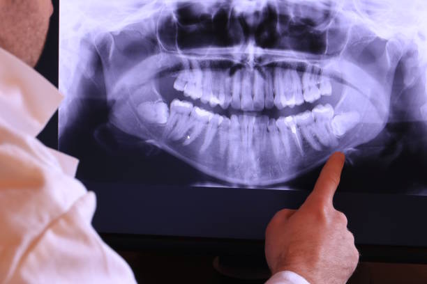 Best Urgent Dental Care for Toothaches in Western Lake, TX