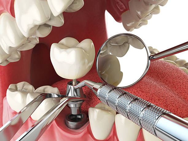 Best Walk-In Emergency Dental Services in Western Lake, TX