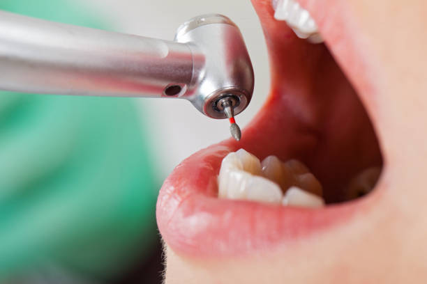 Best Emergency Dental Care for Sports Injuries in Western Lake, TX